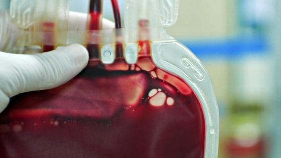 🎧 Avis Firenze: “C’è carenza sangue, ma la burocrazia ci frena”