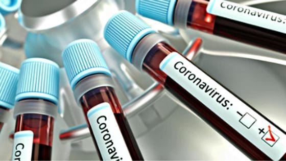 Coronavirus in Toscana, 1.034 nuovi casi, 2 decessi