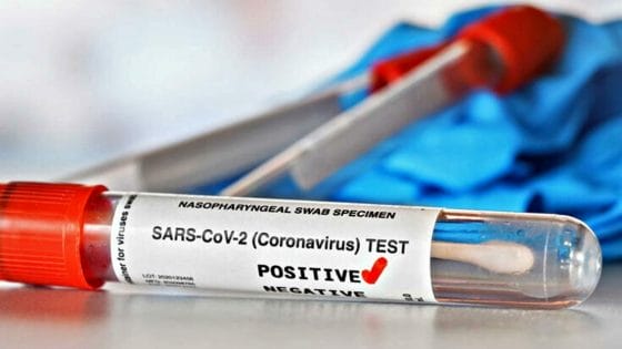 Coronavirus, Toscana:  2.547 nuovi casi, 12 decessi
