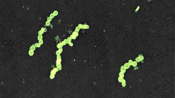 I batteri sono microscopici… non tutti! “Thiomargarita magnifica”, è un batterio di 1cm